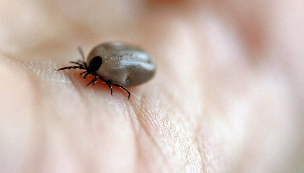 tick bites